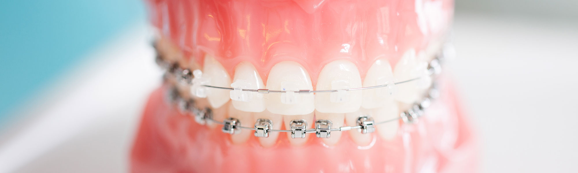 Braces-Friendly Stocking Stuffer Ideas
