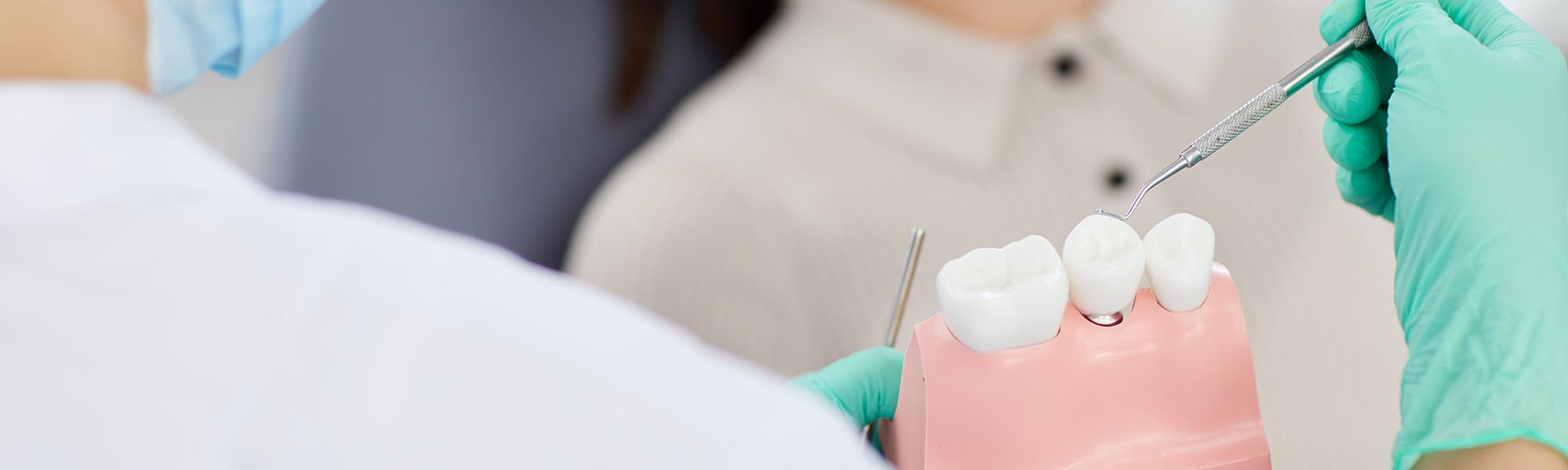 Dental Implants Downey CA
