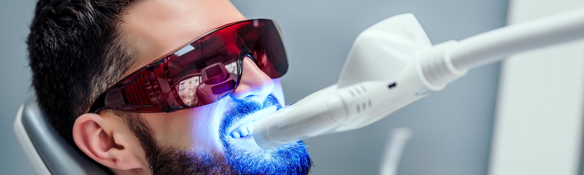 Teeth Whitening Downey CA