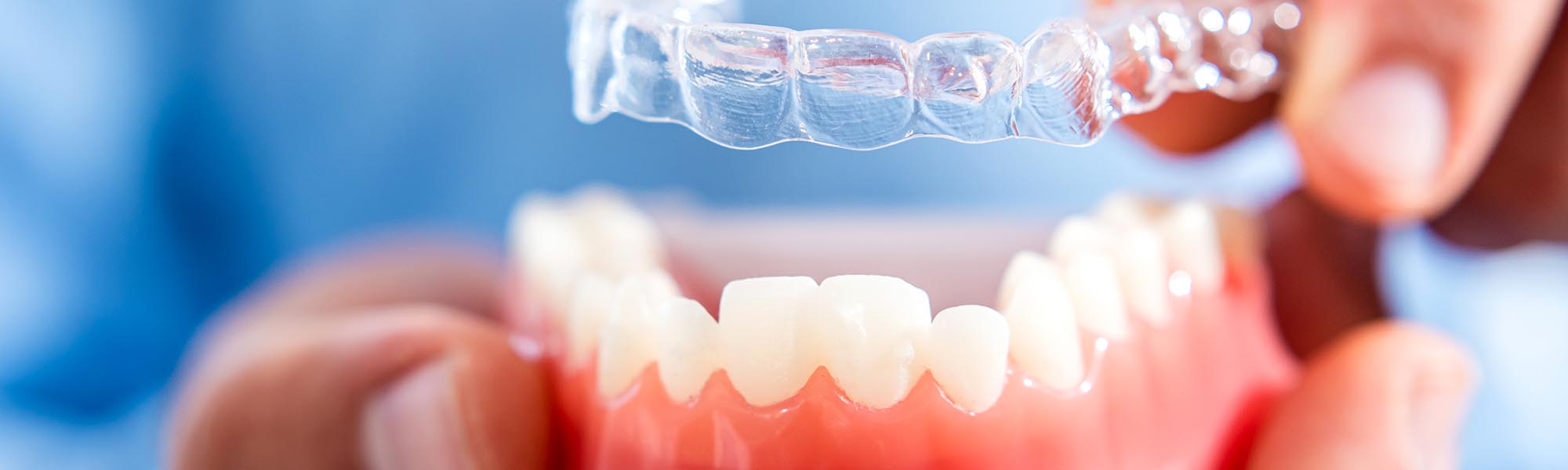 Invisalign® Downey CA