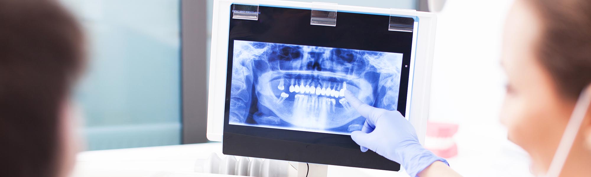 Digital X-rays Downey CA